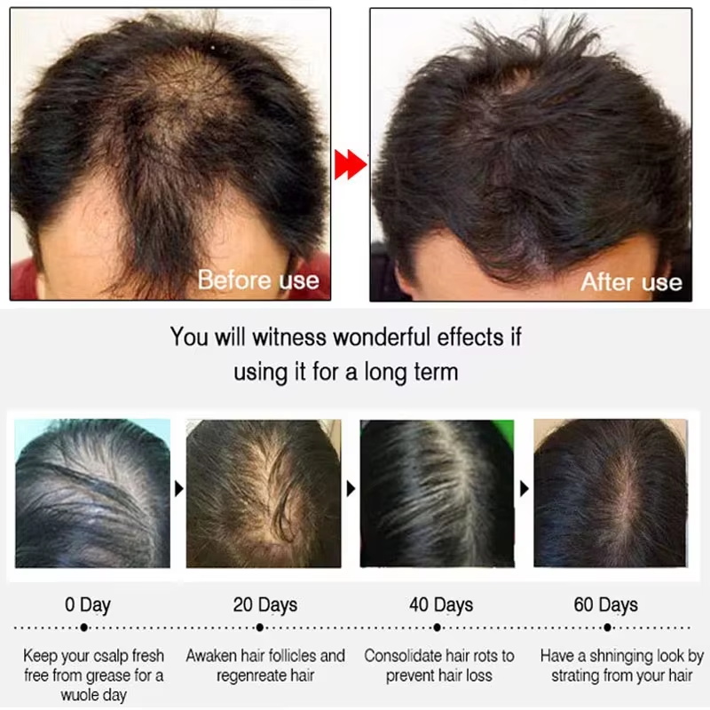 بخاخ الزنجبيل السريع لنمو الشع - مراجعة Hair Care Tonic وسعره