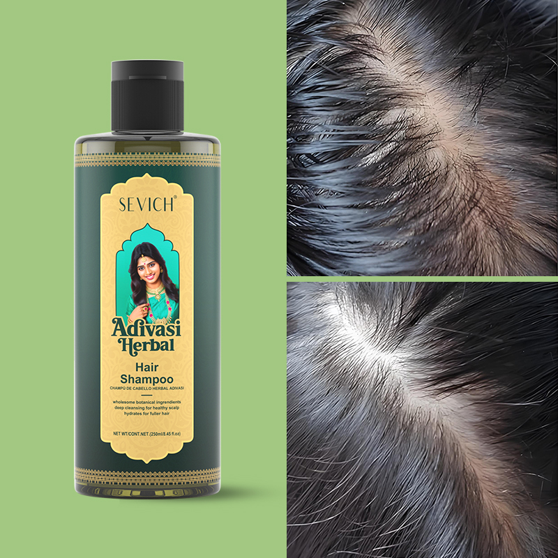 مجموعة زيت نمو الشعر، زيت إكلي - مراجعة Hair Care India وسعره